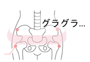 骨盤グラグラ